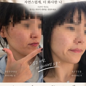 [경기 용인시] 몰디브태닝 역북점