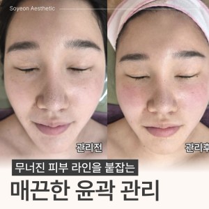 [대구 달서구] 소연에스테틱(피부/바디/두피/탈모}