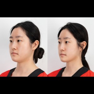 [인천 연수구] 가인미가
